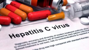hepatitis C