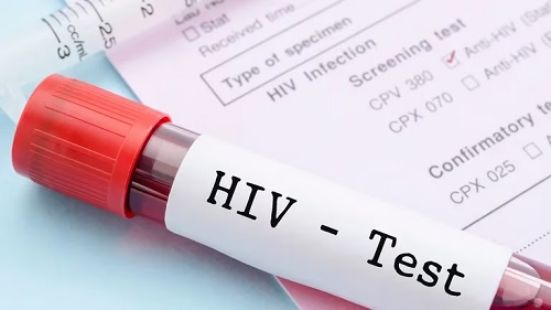 HIV