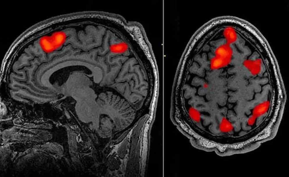 cerebro IA