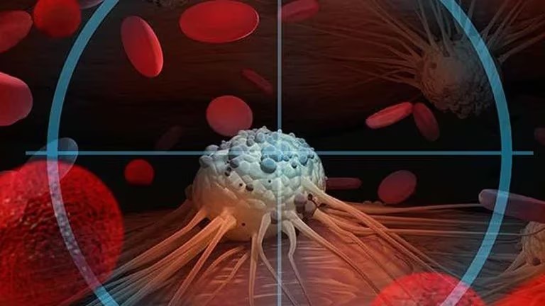 cancer neurona