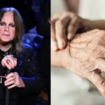Qué es y qué síntomas tiene el mal de Parkinson: la enfermedad que sufría el Indio Solari