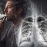 Cáncer de Pulmón: los avances que permiten controlar y superar la enfermedad