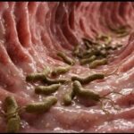 Helicobacter pylori: lo que hay que saber de la bacteria vinculada al cáncer gástrico, sus síntomas y el papel de la dieta