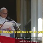 León XIV será operado de un nódulo en pulmón