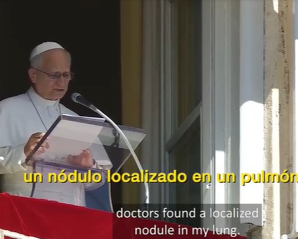 papa Leon nodulo